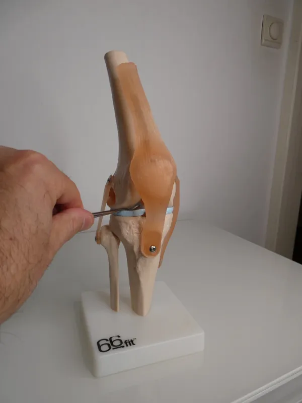 Aura and knee surgery.